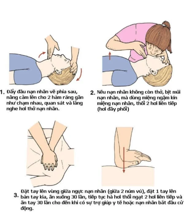31 cách sơ cứ người bị điện giật